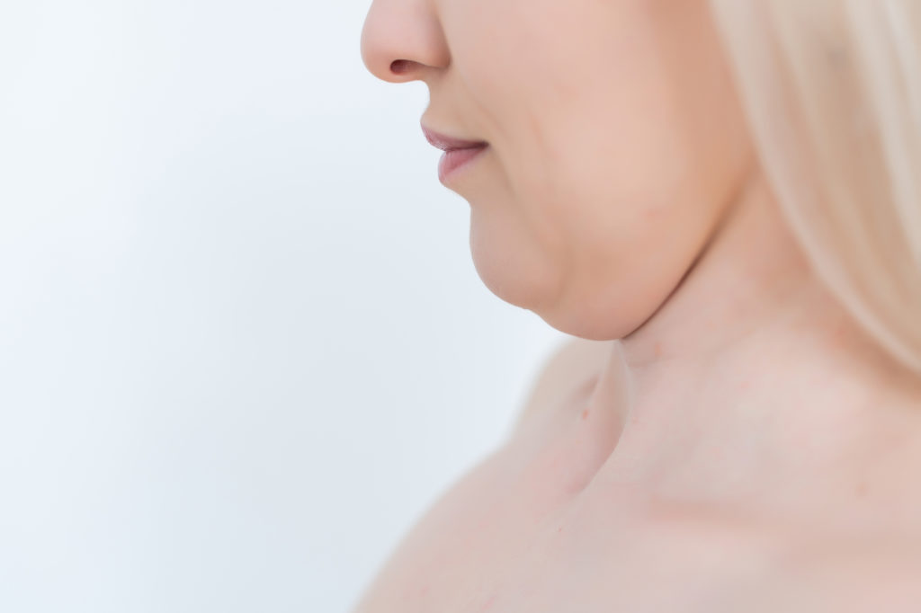 lipo de papada